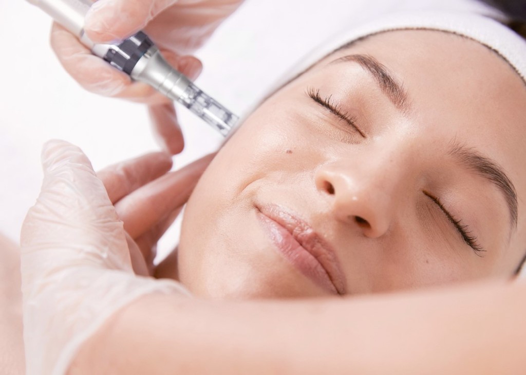 Micro Needling 2